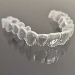 Dental Care Today - Dentists in Forest Hill VIC 3131 - Orthodontic treatment model Affordable Invisalign in Melbourne eastern suburbs